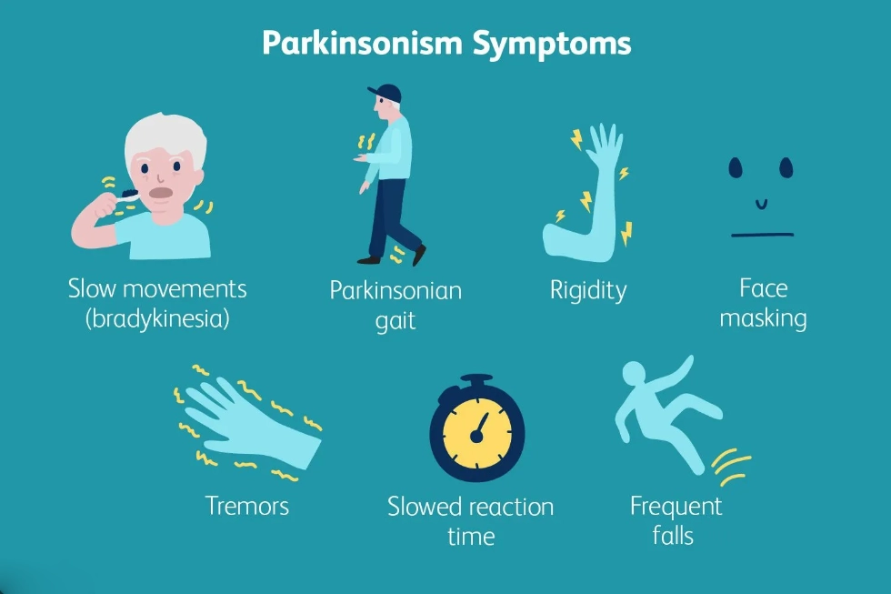 Parkinsons causes symptoms and treatment2