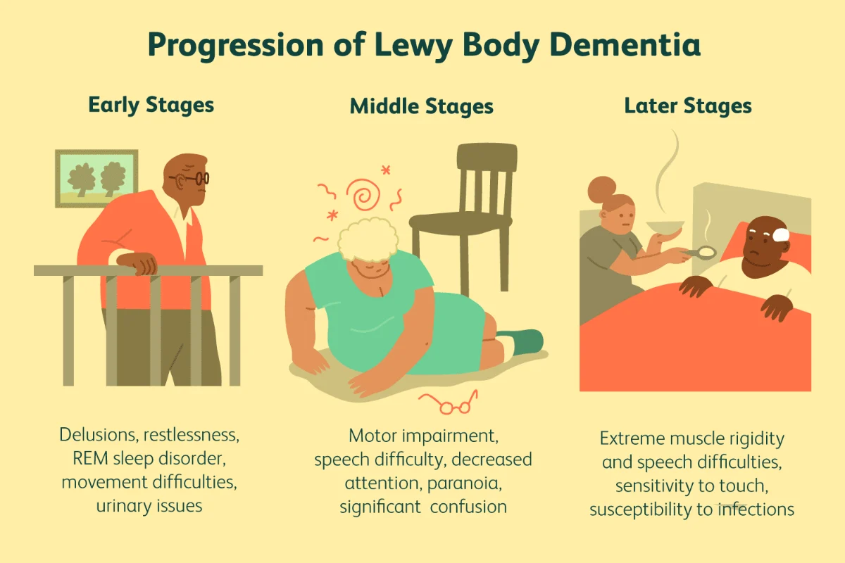 lewy body dementia stages progression